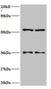 SARS Antibody