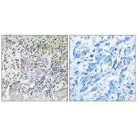 SESN1 Antibody