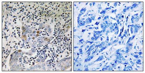 SESN1 Antibody