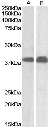 SET/I2 alpha PP2A Antibody