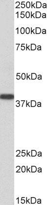 SET/I2 alpha PP2A Antibody