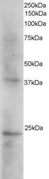 SET/I2 alpha PP2A Antibody