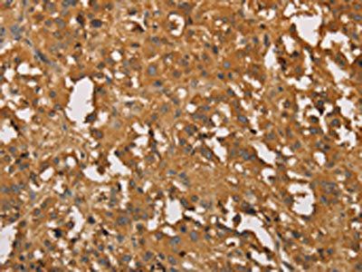 SETD2 Antibody