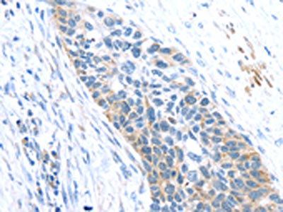SFTPA1 Antibody