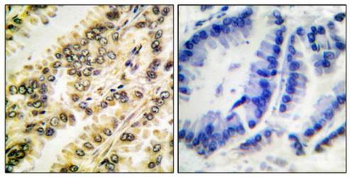 SGK (Phospho-Ser422) Antibody