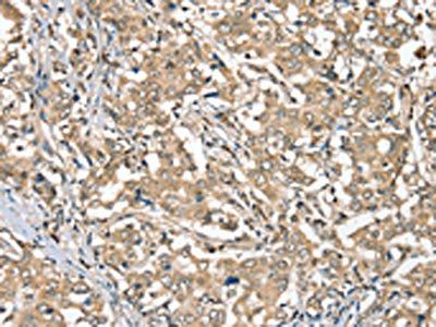 SGPL1 Antibody