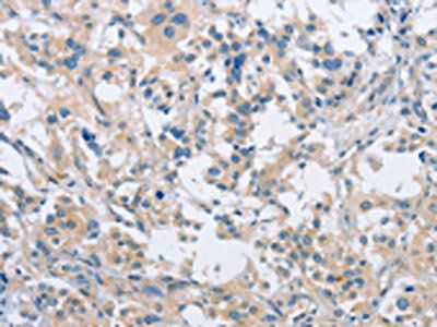 SH3GLB1 Antibody