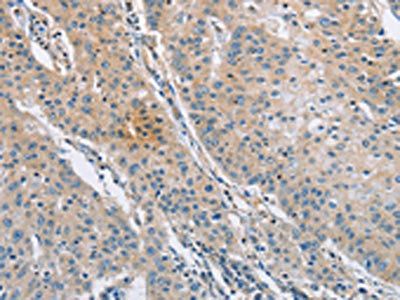 SH3GLB1 Antibody