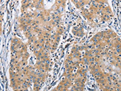 SH3GLB1 Antibody