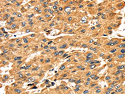 SH3KBP1 Antibody