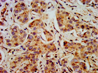 SHANK2 Antibody