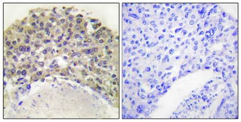 Shc (Phospho-Tyr349) Antibody