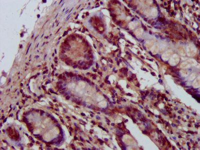 SHPRH Antibody