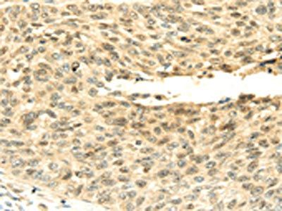 SHPRH Antibody