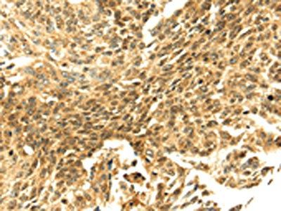SHPRH Antibody