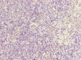 SIK3 Antibody