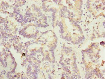 SIK3 Antibody