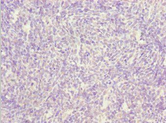 SIK3 Antibody