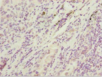 SIK3 Antibody