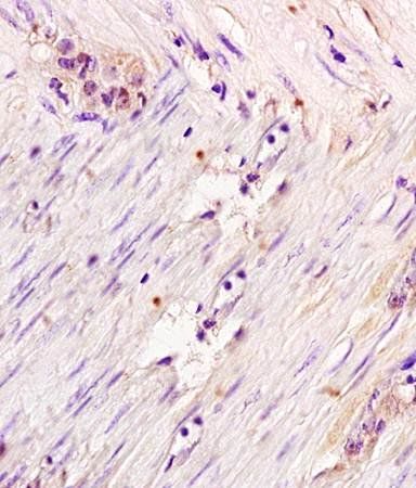 Gemin 2 Rabbit Polyclonal Antibody