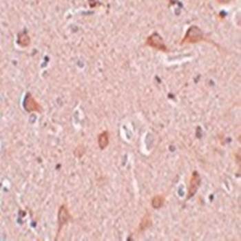 SIPA1L1 Antibody