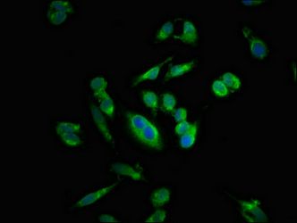 SIRT5 Antibody