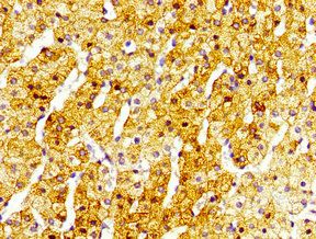 SIRT5 Antibody