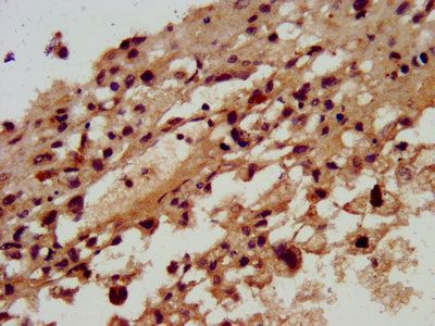 SKA3 Antibody
