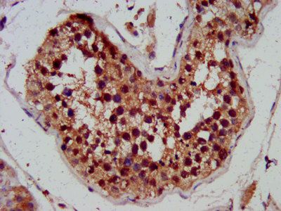 SKA3 Antibody