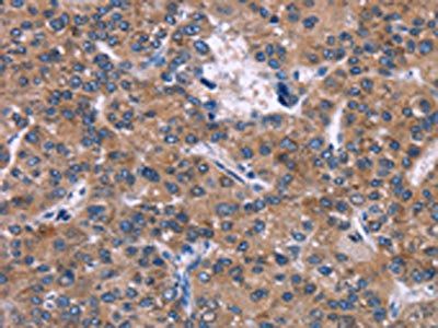 SKI Antibody