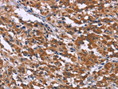 SKI Antibody
