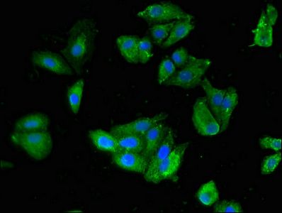 SKIL Antibody