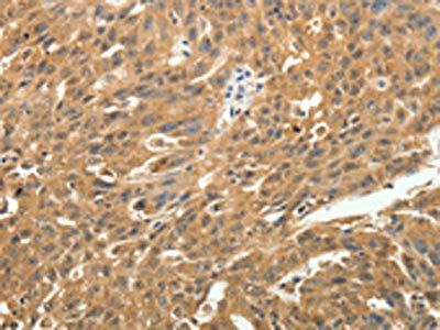 SKP1 Antibody