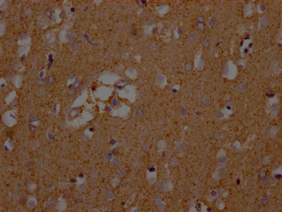 SLC1A3 Antibody