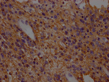 SLC1A3 Antibody