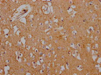 SLC1A3 Antibody