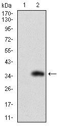 SLC27A2