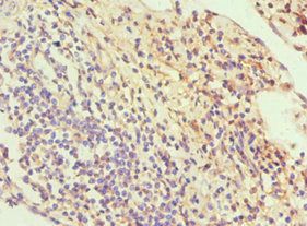 SLC2A1 Antibody