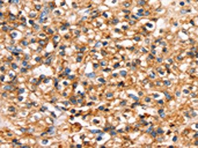 SLC34A3 Antibody