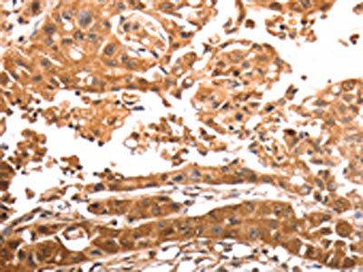 SLC39A6 Antibody