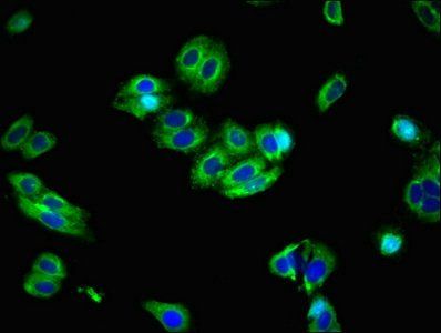 SLC39A8 Antibody