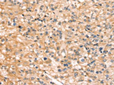 SLC44A1 Antibody
