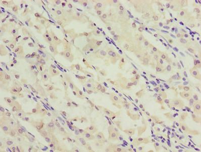 SLC52A2 Antibody