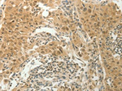 SLC8A3 Antibody
