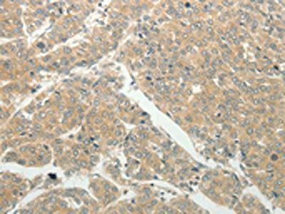 SLC8A3 Antibody
