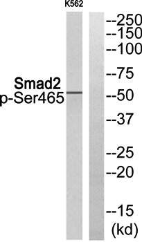Smad2 (Phospho-Ser465) Antibody