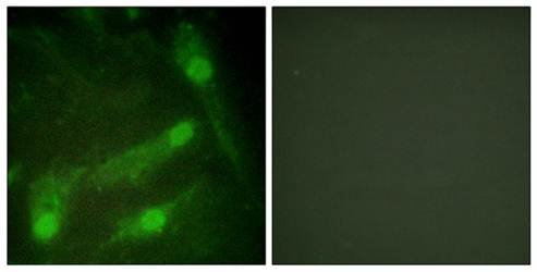 Smad2 (Phospho-Thr220) Antibody