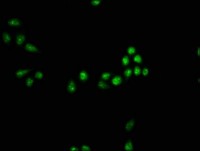 SMAD7 Antibody