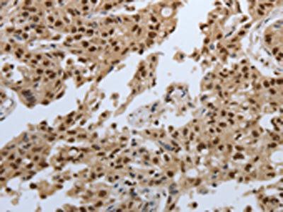 SMAD7 Antibody