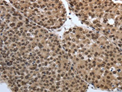 SMAD7 Antibody